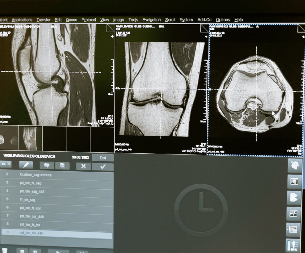 Soluciones Healthcare Plataforma Colaborativa RIS/PACS - Dicipa
